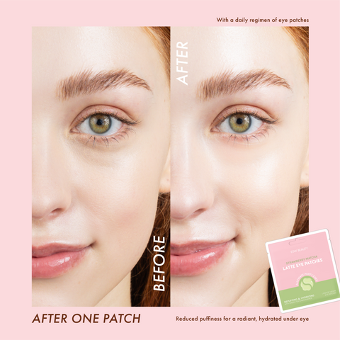 Strawberry Matcha Latte Depuffing & Hydrating Eye Patches - ESW Beauty
