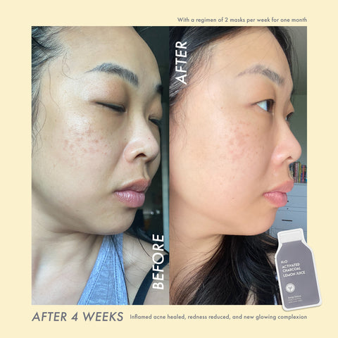 Deep Detox Pore Control Raw Juice Mask - ESW Beauty