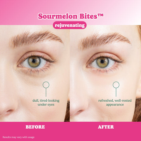 [archive] ESW Beauty x SmartSweets Sourmelon Bites™ Rejuvenating Eye Patches - ESW Beauty