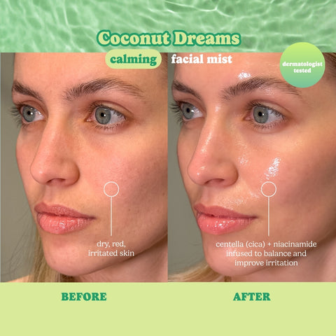 Coconut Dreams Calming Infused Water Facial Mist - ESW Beauty