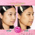 Dose of Moisture Hydrating Hydrogel PDRN Face Mask - ESW Beauty