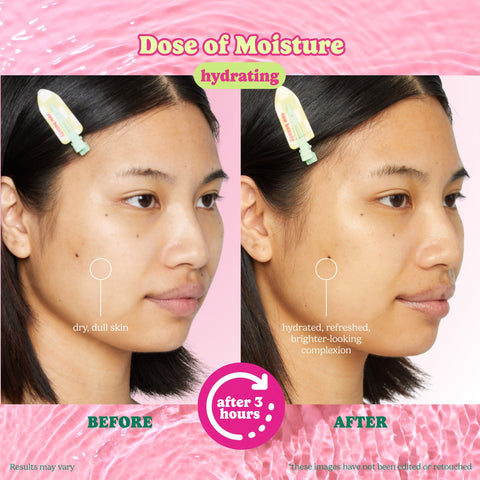 Dose of Moisture Hydrating Hydrogel PDRN Face Mask - ESW Beauty